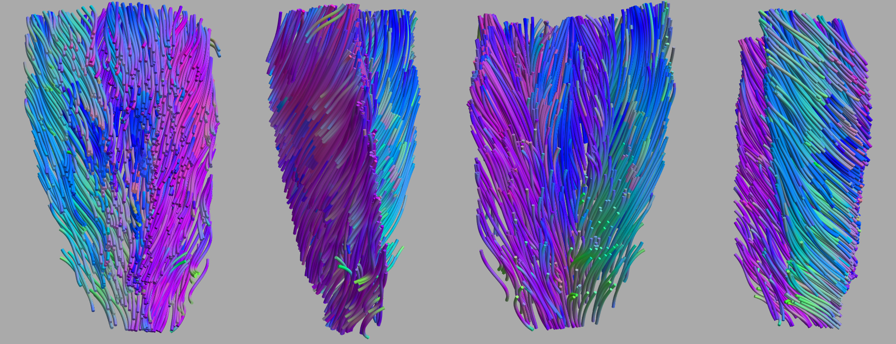 muscles fiber tractography